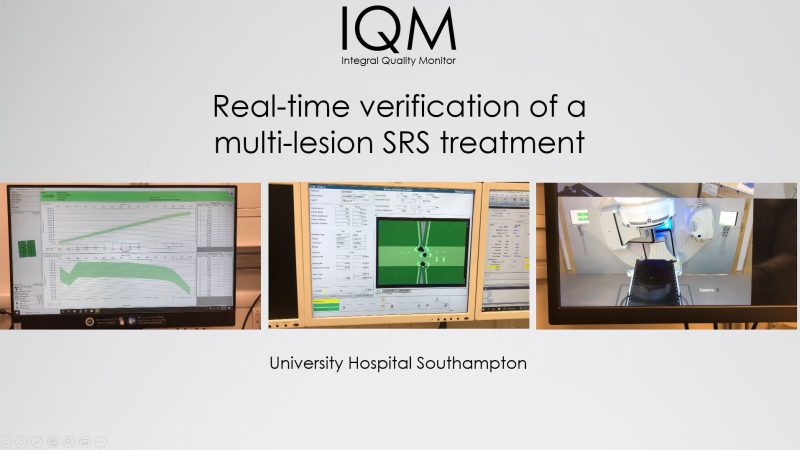 multi-lesion srs qa